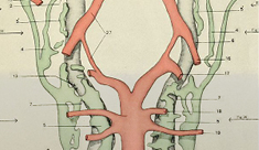 Linfedema: qué es y cómo prevenirlo