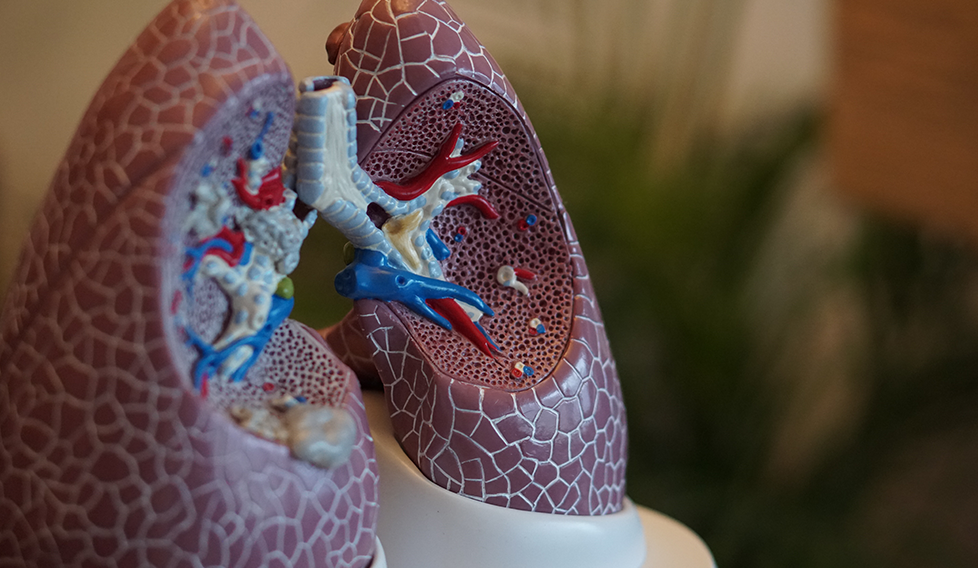despres-del-cancer-de-pulmo-consideracions-sobre-la-radioterapia