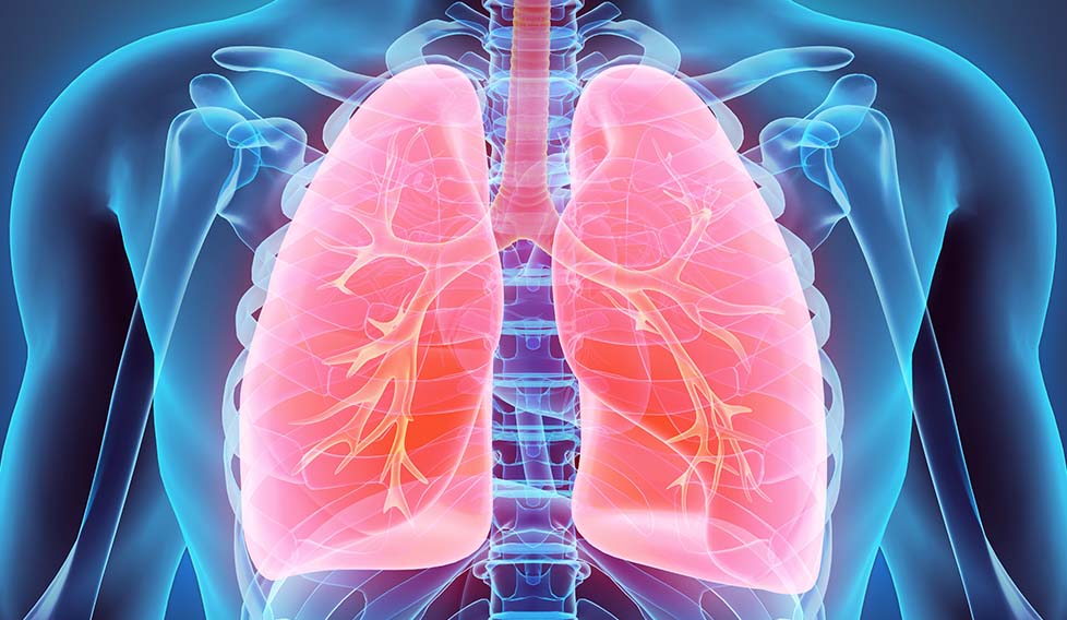 Rehabilitació pulmonar després del càncer de pulmó